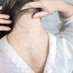 hair loss fact